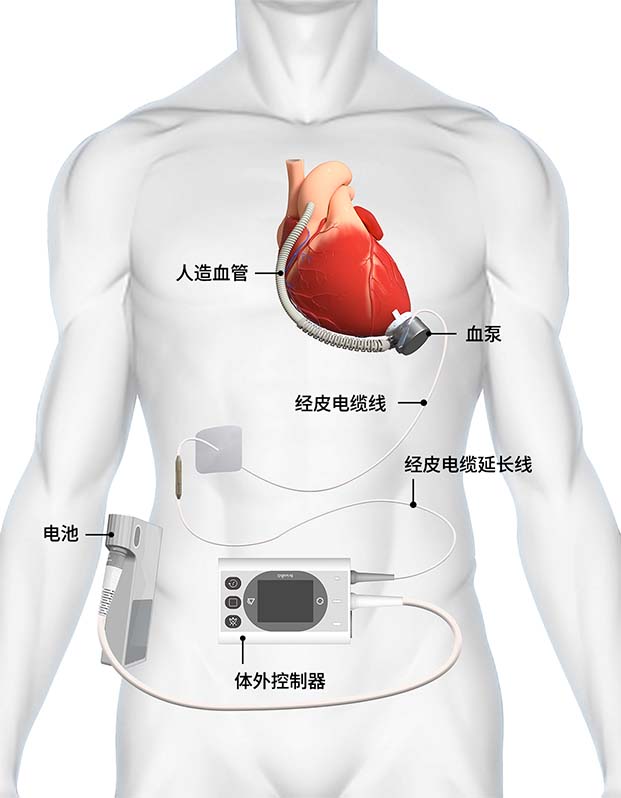 秋霞鲁丝片Av无码少妇